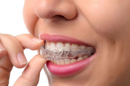 pros-and-cons-of-invisalign.jpg